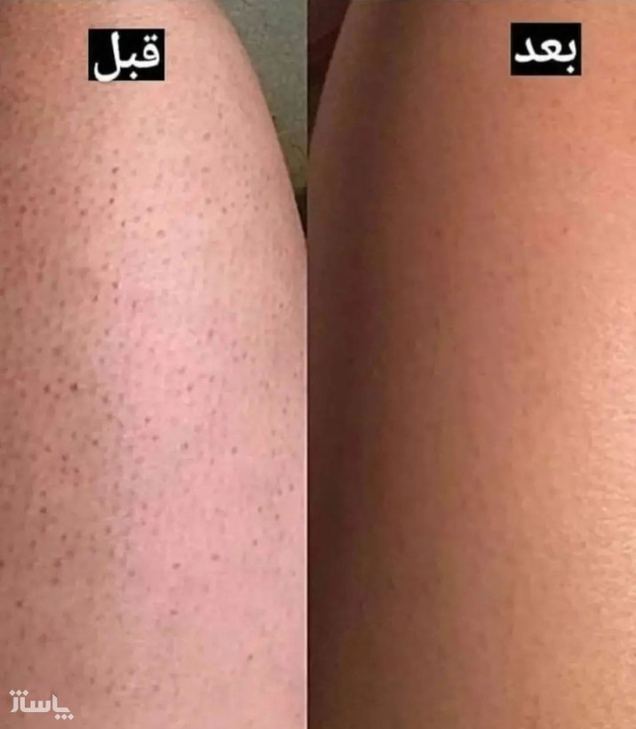 نمک بدن هلو بیواکوا 250 میلی